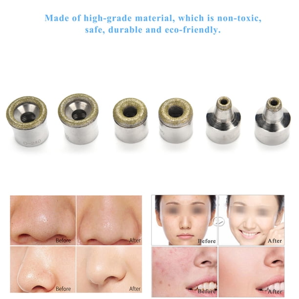 Puntas De Dermoabrasión, Puntas De Diamante De Dermoabrasión Prácticas, 6 Piezas útiles Para La Dermoabrasión De Diamante Que Elimina Las Imperfecciones De La Piel De Acero ANGGREK Diamond Filter