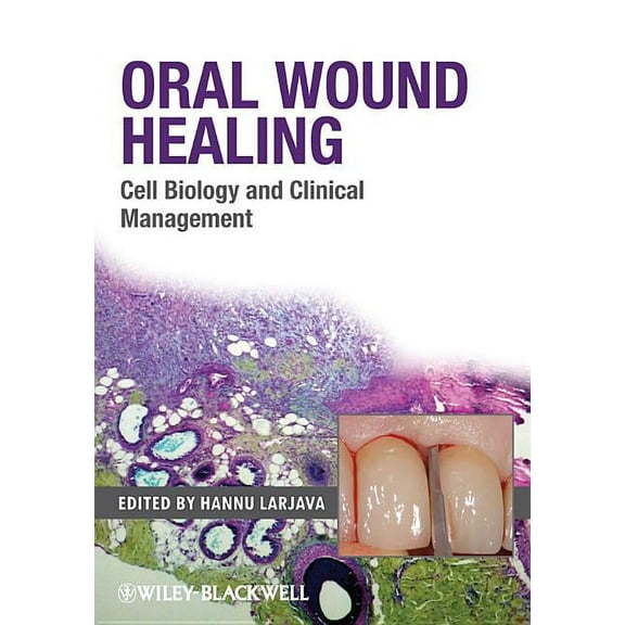 Oral Wound Healing: Cell Biology and Clinical Management (Hardcover)
