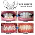 thumbnail image 4 of Dental Orthodontic Teeth Corrector Silicone Braces Retainer Straighten Tools Teeth Capped for Adults Tooth Care Tools 3 Phases, 4 of 5