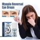 thumbnail image 2 of Gotas para eliminar cataratas, mejorar la visión borrosa, restaurar la vista, aliviar la infección del globo ocular, tratamiento para ojos secos y rojos con picazón, 2 of 5