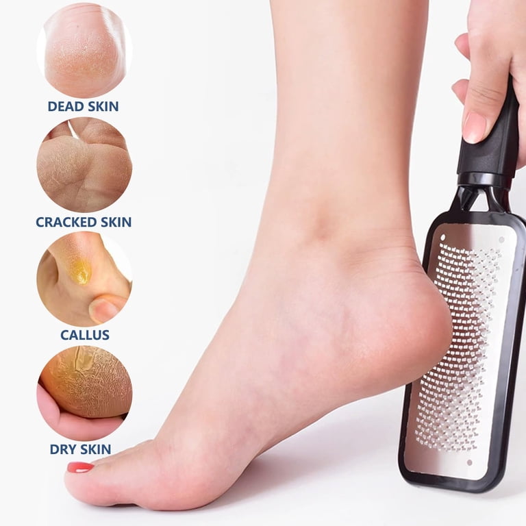 Double Sided Foot File & Callus Remover – Pedicure Scrubber For Hard Dead Skin – Manual Foot Rasp 2 thumbnail image