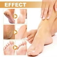 thumbnail image 6 of Fankiway Foot Callus Remover Spray Improve Dryness And Roughness, And Replenish Skin With Moisturing 30ml, Beauty & Personal Care, 6 of 8