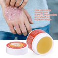 thumbnail image 2 of Ungüento antipruriginoso para la piel, crema antibacteriana para pie de atleta, para Beriberi, picazón, tiña, dermatitis, eccema, 2 of 5