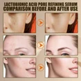 thumbnail image 4 of Suero Facial retráctil de poros, esencia reparadora, hidratante, nutre los poros, reafirmante, cuidado Facial, elimina puntos negros, acné, acidez, Control de aceite, 4 of 5