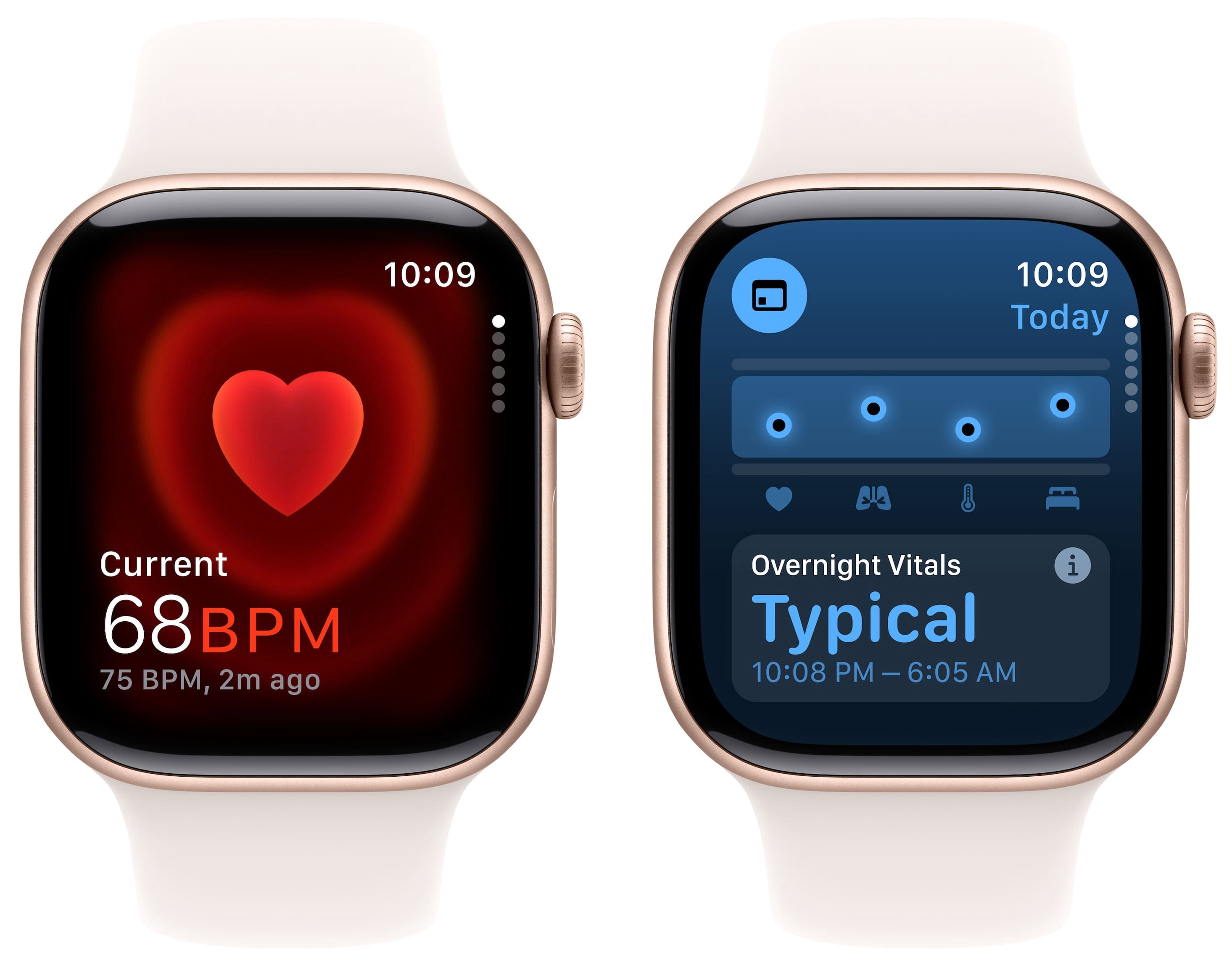 Restored Apple Watch Series 10 Aluminum 42mm A3001 (GPS + Cellular) Rose Gold (Refurbished)
