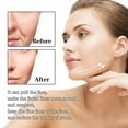 thumbnail image 4 of Cinta De Estiramiento Facial ANGGREK Ultra Delgado Invisible V, 4 of 8