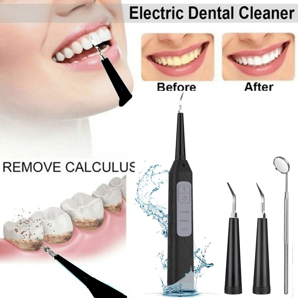 Queenmew Ultrasonic Tooth Cleaner Plaque Remover Teeth Electric Scaler