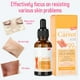 thumbnail image 5 of Face Serum Whitening Face Serum Anti Aging Face Essence 30ml Face Serum Whitening Anti Aging Anti Wrinkles Moisturizing Facial Lifting Essence Carrot ANGGREK Otros, 5 of 8