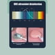 thumbnail image 4 of Esterilizador portátil UV para cepillos de dientes y soporte | Estuche desinfectante recargable para viaje | Limpieza rápida en 5 minutos | Diseño compacto para uso doméstico y de viaje, 4 of 5
