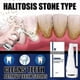 thumbnail image 2 of 30ml Calculus Dissolving Dental Spray Oral Tooth Cleaner Tartar Remover Tw, 2 of 4