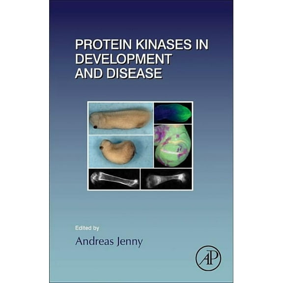Current Topics in Developmental Biology Protein Kinases in Development and Disease: Volume 123, Book 123, (Hardcover)