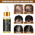 thumbnail image 4 of Hair Growth and Nourishing Essence - Hair Care Essential Oil for Strong, Soft, a, 4 of 5