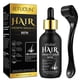 thumbnail image 1 of 5% Minoxidil Hair Growth Oil for Men and Women - Regrowth Serum, Extra Strength Spray for Hair Loss, Thicker Healthier Hair, Beard Growth Kit, Topical Treatment, 2.02 oz, 1 of 5