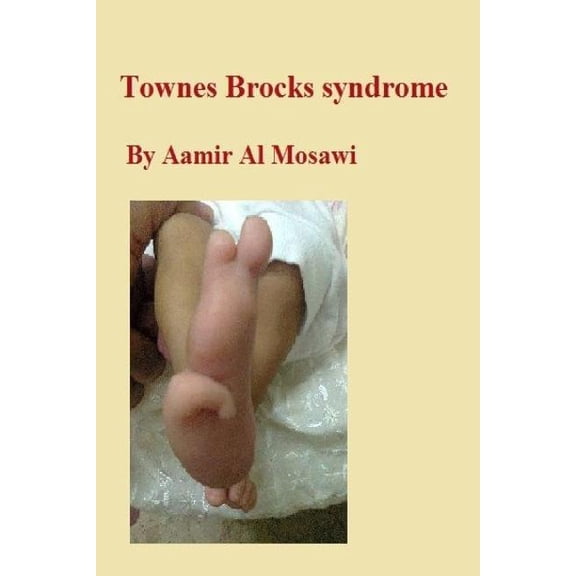 Townes Brocks Syndrome: Clinical Genetics