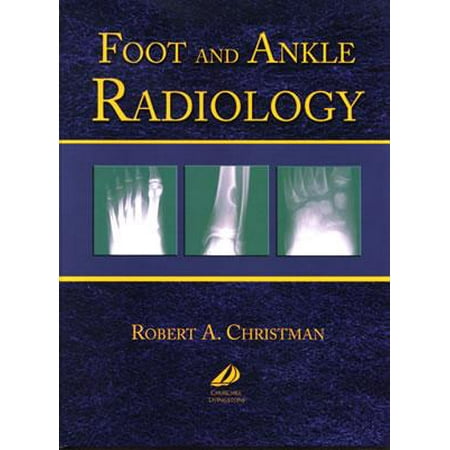 Foot and Ankle Radiology (Hardcover) 9780443087820