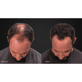 thumbnail image 5 of LUXE Hair Thickening Fibers with Natural Keratin-2 Months+ Supply!-Confidence in a Jar! - Dark Brown - Multiple Colors Available, 5 of 9