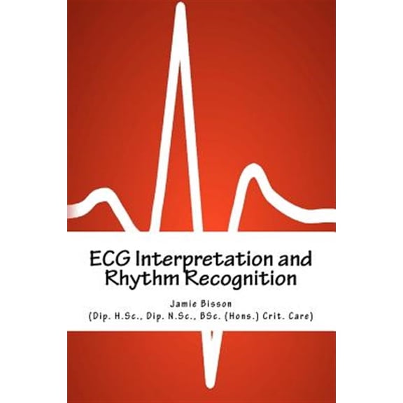 Pre-Owned ECG Interpretation and Rhythm Recognition (Paperback)