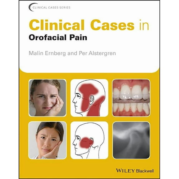 Clinical Cases (Dentistry): Clinical Cases in Orofacial Pain (Paperback)