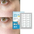 thumbnail image 2 of Milia Remover Patch Sticker Moisturize Clean Patch Milia Remover Skin for Fat Granules Eye, 2 of 9
