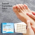 thumbnail image 2 of Ingrown Toenails Correction Patch, 6 Sheets Physical Straightening Elastic Cotton Glue Patch Toenail Pedicure Tool, Curved Toenails Brace Thick Paronychia Correction Recover Treatment (60PCS), 2 of 10