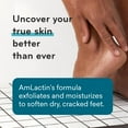 AmLactin Foot Repair Foot Cream Therapy, 3 oz + One Pair Moisturizing
