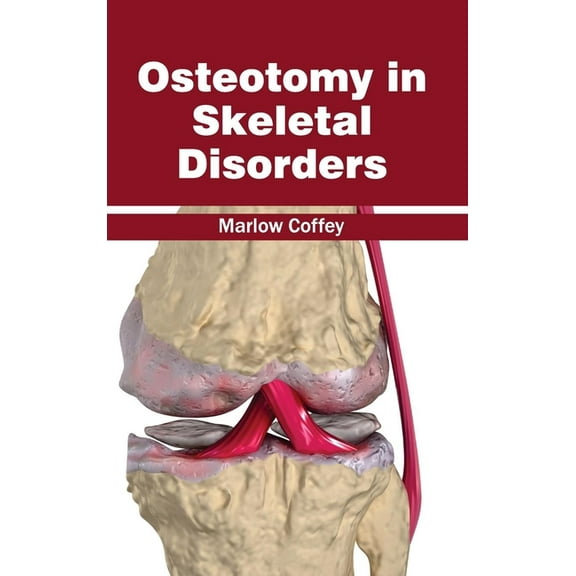 Osteotomy in Skeletal Disorders, (Hardcover)