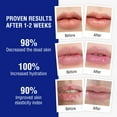 thumbnail image 4 of OUKEYA Medex Medicated Lip Balm with Beeswax, Petrolatum, Peppermint Oil,3 Pack, 4 of 8