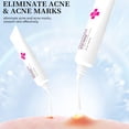 thumbnail image 3 of Crema para el acné, antimanchas, cicatriz de acné, crema para eliminar espinillas, reduce los poros, blanquea, hidratante, cuidado de la piel facial, 3 of 5