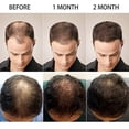 thumbnail image 4 of Sérum capilar de agua de arroz fermentada con biotina para un rápido crecimiento del cabello, nutrición profunda y protección contra daños, 3 unidades., 4 of 5