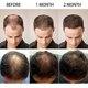 thumbnail image 4 of Sérum capilar de agua de arroz fermentada con biotina para un rápido crecimiento del cabello, nutrición profunda y protección contra daños, 3 unidades., 4 of 5