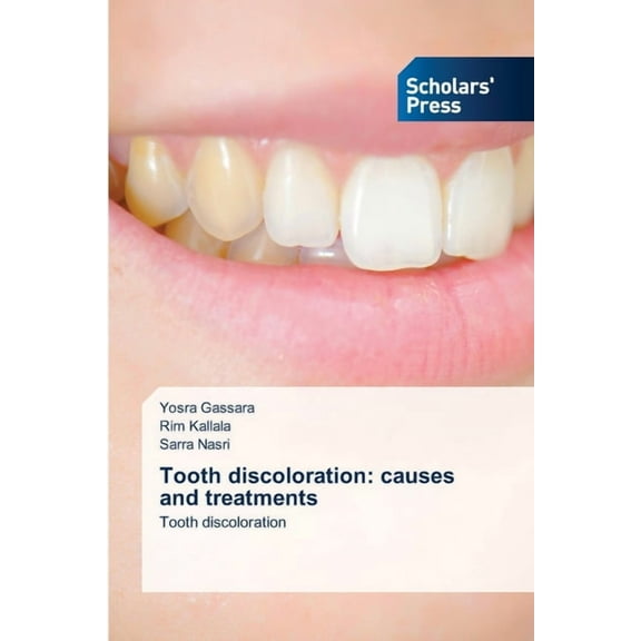 Tooth discoloration: causes and treatments, (Paperback)