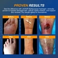 thumbnail image 4 of LAVIOR Hydrogel Wound Dressing: A Complete Natural Gel for Faster Healing of Wounds, Burns, and Cuts, 4 of 7