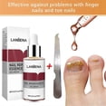 thumbnail image 4 of 12ml Nail Fungal Treatment With File Anti Fungus Onychomycosis Removal Nails Care Repair Liquid, 4 of 5