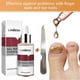 thumbnail image 4 of 12ml Nail Fungal Treatment With File Anti Fungus Onychomycosis Removal Nails Care Repair Liquid, 4 of 5