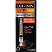 Lotrimin Ultra with No Touch Applicator, 1 Week Athlete's Foot Treatment Cream. Prescription Strength Butenafine Hydrochloride 1%, Cures Most Athletes Foot Between Toes, Antifungal, 0.7 oz (20