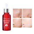 thumbnail image 4 of Exfoliate Hyaluronic - Hydrating Toning Solution - Exfoliate - Reduce Redness - And Your Skin30ml, 4 of 7