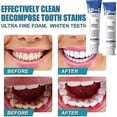 thumbnail image 2 of Sp 6 Toothpaste, Ultra Whitening Toothpaste Sp-6, Sp-6 Ultra Whitening Probiotic Brightening Toothpaste, Fresh Breath Stain Removal, 2 of 4