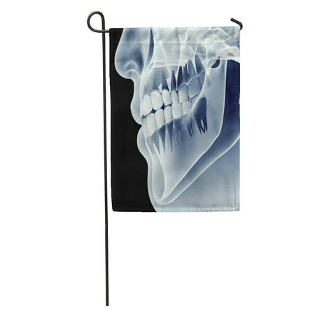 SIDONKU Xray X Ray of Jaw Teeth Mouth Human Radiography Dental Dentist Garden Flag Decorative Flag House Banner 12x18 (Best Dental Xray Sensor)