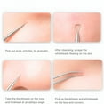 thumbnail image 3 of RAGUPEL 2026 New Blackhead Removal Tool, Pimple Popper Extractor Tool Kit, Used for Removing Blackheads, Acne, Comedone, Flaw White Heads on Nose and Face, Professional Stainless Steel Removal Tool., 3 of 5