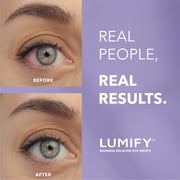 Lumify Eye Drops for Redness Relief and Whiter and Brighter Looking Eyes, .08 fl oz (2.5 ml)