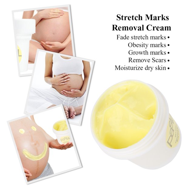 Crema Estrías Eliminación De Obesidad Reparación De Cicatrices Posparto Embarazo Piel Crema Reparadora Corporal 50ml