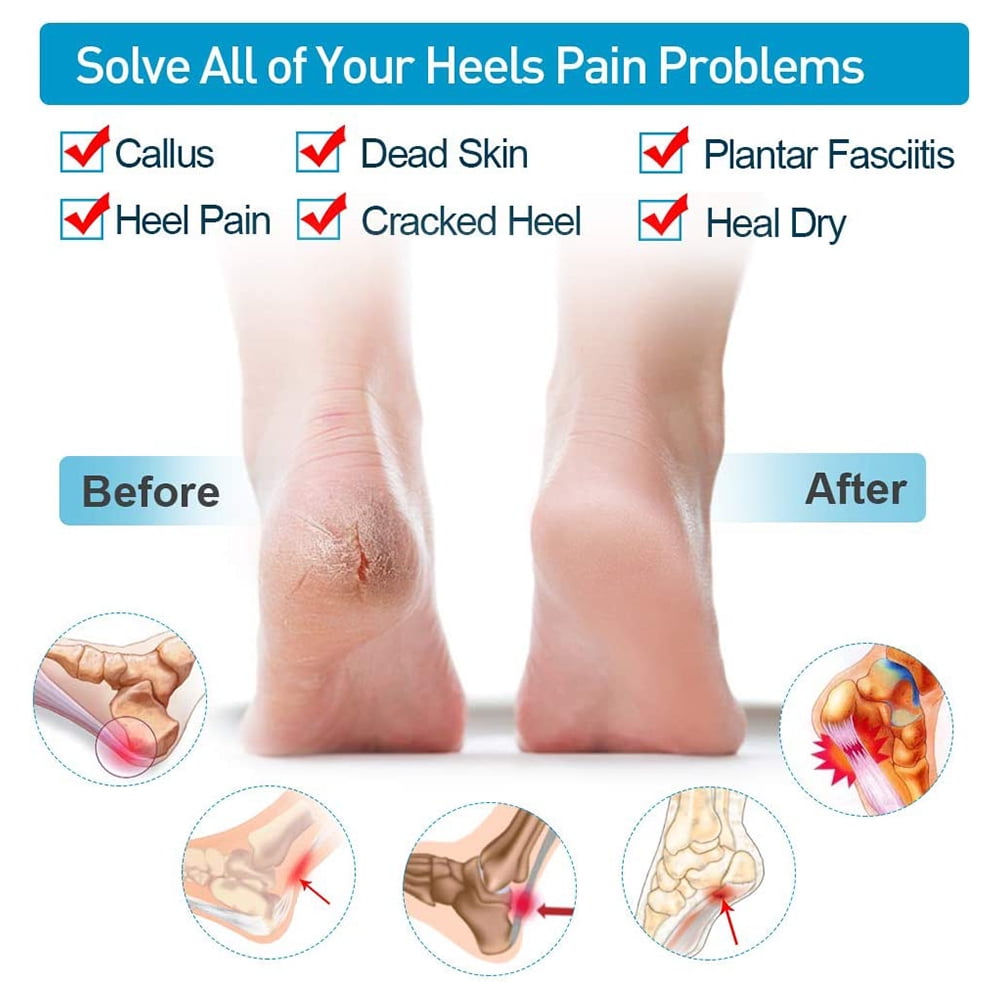 Breathable Heel Cups Great for Heel Pain Achilles Tendinitis for Men & Women Heal Dry Cracked Heels Heel Pads Cushion 6 Pairs Plantar Fasciitis Inserts 