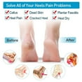 thumbnail image 5 of 3Pairs Breathable Heel Cups, Plantar Fasciitis Inserts, Heel Pads Cushion Great for Heel Pain, Heal Dry Cracked Heels, Achilles Tendinitis, for Men & WomenWhite, 5 of 8