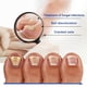 thumbnail image 5 of Nail Repair Essences Multipurpose Onychomycosis Care Solution Nail Care Supplies, 5 of 5