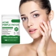 thumbnail image 2 of Kit de pegatinas para el tratamiento del acné, parches ultrafinos para eliminar espinillas y acné, 24 Uds. Tmvgtek cuidado belleza, 2 of 5