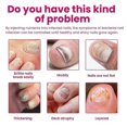 thumbnail image 3 of Ginger Nail Treatment - Nail Fungus Removal, Nail Fungus Treatment for Toenail Strengthens and Smooths Cracked Nail Surface, Ginger Nail Essence Repai, 3 of 5