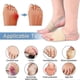 thumbnail image 3 of Toe protector for tailors bunion and daily wear, 3 of 5