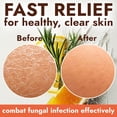 thumbnail image 6 of Antifungal Soap with Lemon Oil | Medicated Jock Itch Treatment Helps Fight Ringworm & Athlete’s Foot | Tolnaftate 1% Antifungal Cleansing Bars with Case | Infused with Sweet Orange & Grapefruit Oils, 6 of 6