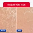thumbnail image 4 of Heal & Rescue Super Crack Foot Cream for Calluses, 4.4oz, 4 of 9