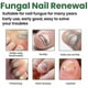 thumbnail image 2 of Onychomycosis Repair Liquid Onychomycosis Nail Removal Bad Armor Thick Bright Nail Repai, 2 of 5